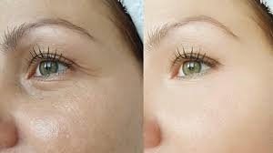 skincare naturale pelle impura